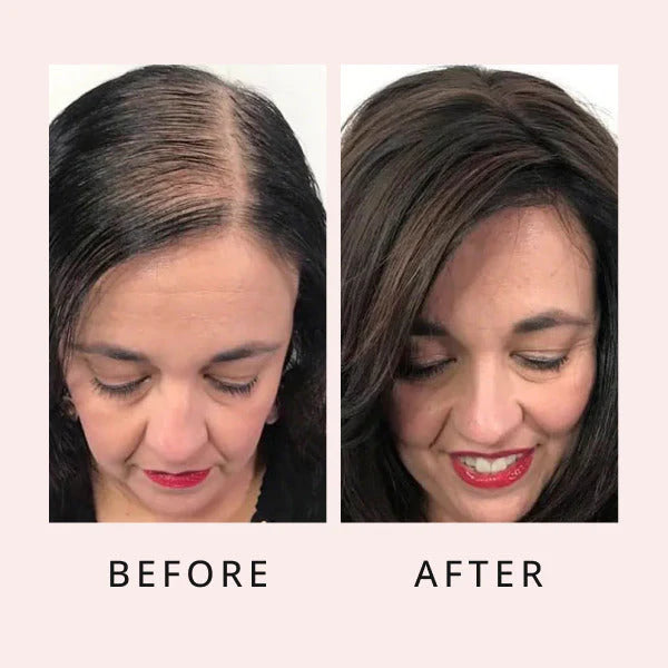 BlissCrown® Breo Brush Scalp Massager